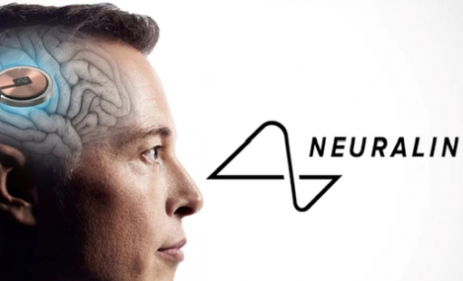 Công ty của Elon Musk cấy chip vào não người chỉ trong 1,5 giây, độ chính xác cực cao giúp tránh các mạch máu nhỏ