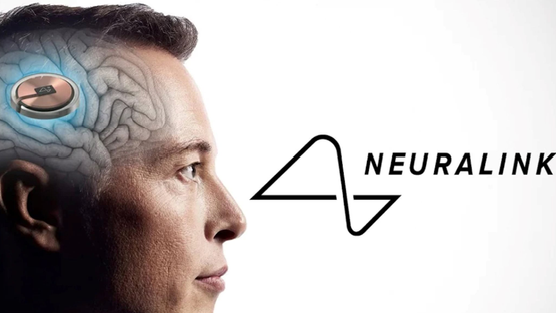 Công ty của Elon Musk cấy chip vào não người chỉ trong 1,5 giây, độ chính xác cực cao giúp tránh các mạch máu nhỏ
